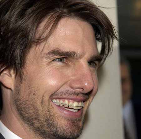 tom cruise had braces